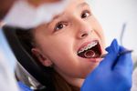 Teeth Braces Options: A Complete Guide to Modern Orthodontic Treatments